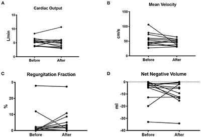 Feasibility of Wave Intensity Analysis in Patients With Conotruncal Anomalies Before and After Pregnancy: New Physiological Insights?